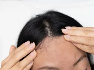 Skin & Hair Problems